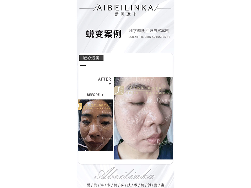 对比案例