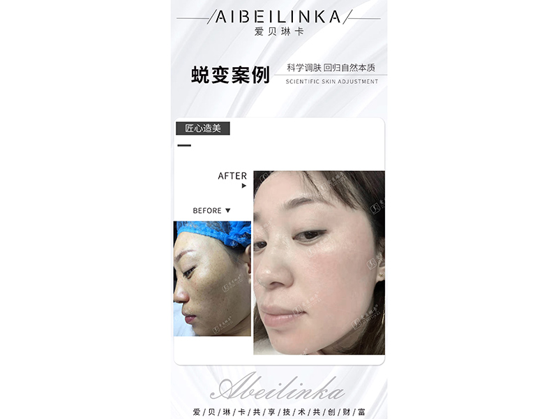 对比案例